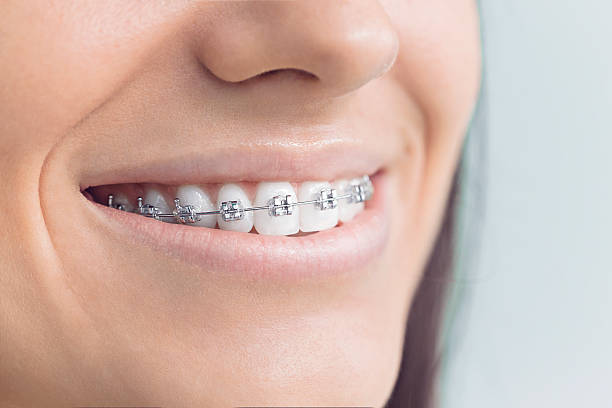 Best Veneers and Lumineers  in Vaiden, MS